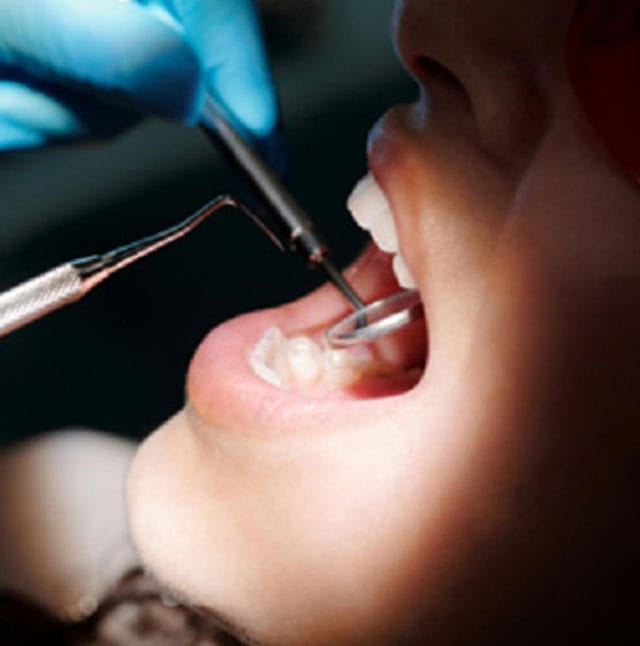 Dental work